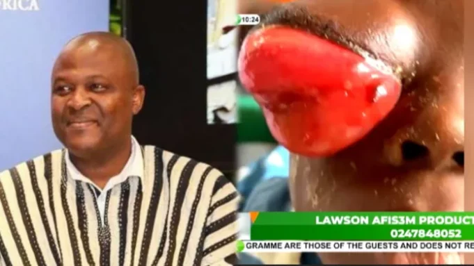 The doctors said we should bring money for surgery but we don’t have it- parents of 3-year-old child battling an eye problem cry as they beg Ibrahim Mahama for help