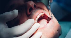 Your mouth on weed is nothing to smile about – Dentist