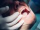 Your mouth on weed is nothing to smile about – Dentist
